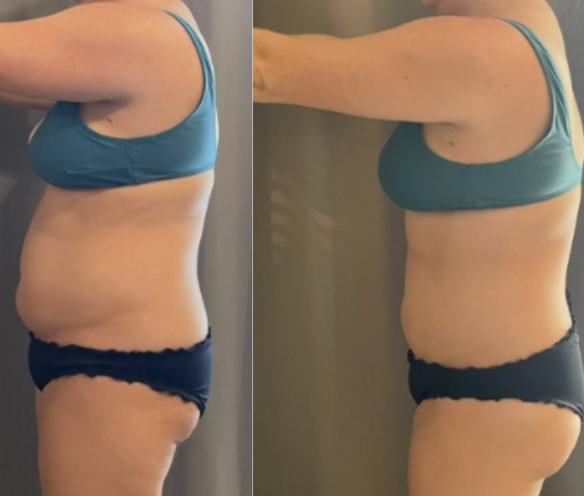 Before and after image 